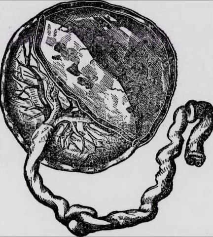 Yes, the umbilical cord.