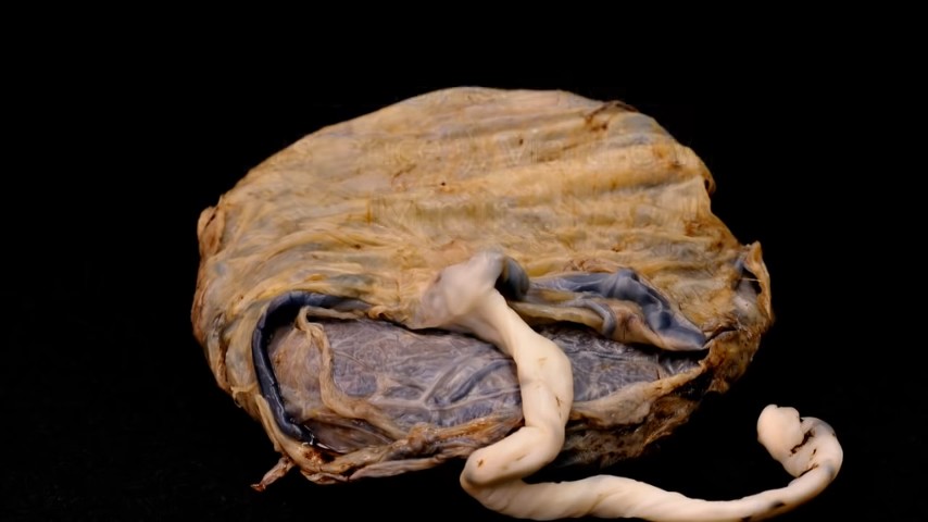 In other words, from the placenta, via the umbilical cord.